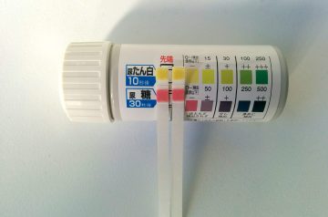 尿が泡立つ蛋白尿を自分で検査してみた　自己治療中