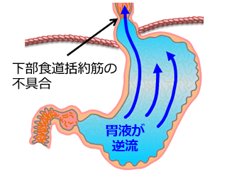 gyakuryuusei_003_3