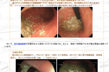 逆流性食道炎なら、米はなるべく控えよう。