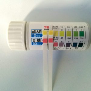 尿が泡立つ蛋白尿を自分で検査してみた　自己治療中